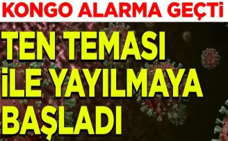 Bu salgın ten temasıyla yayılmaya başladı: Devlet alarma geçti