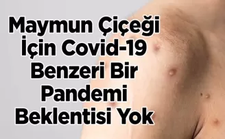 Maymun Çiçeği İçin Covid-19 Benzeri Bir Pandemi Beklentisi Yok
