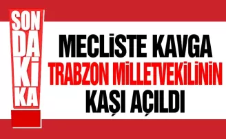 TBMM’de Kavga! Trabzon Milletvekilinin kaşı açıldı