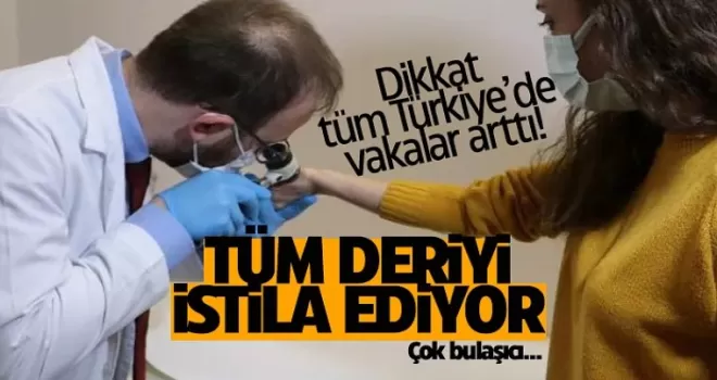 Dikkat! Türkiye'de sayı giderek artıyor... Belirti göstermeden hızlıca bulaşıyor!