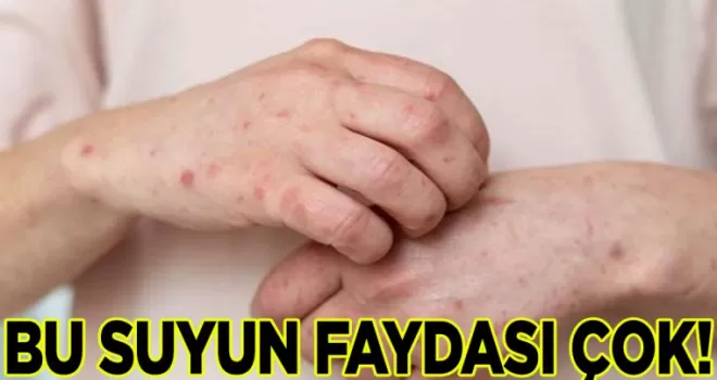 Herkesin evinde var: Cilde çok iyi geldiği açıklandı
