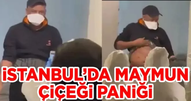 İstanbul’da Maymun Çiçeği Paniği! Virüs Yayılmaya Başladı Mı?
