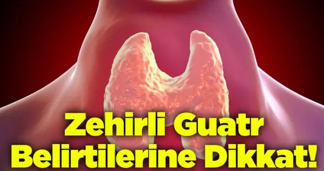 Zehirli Guatr Belirtilerine Dikkat!